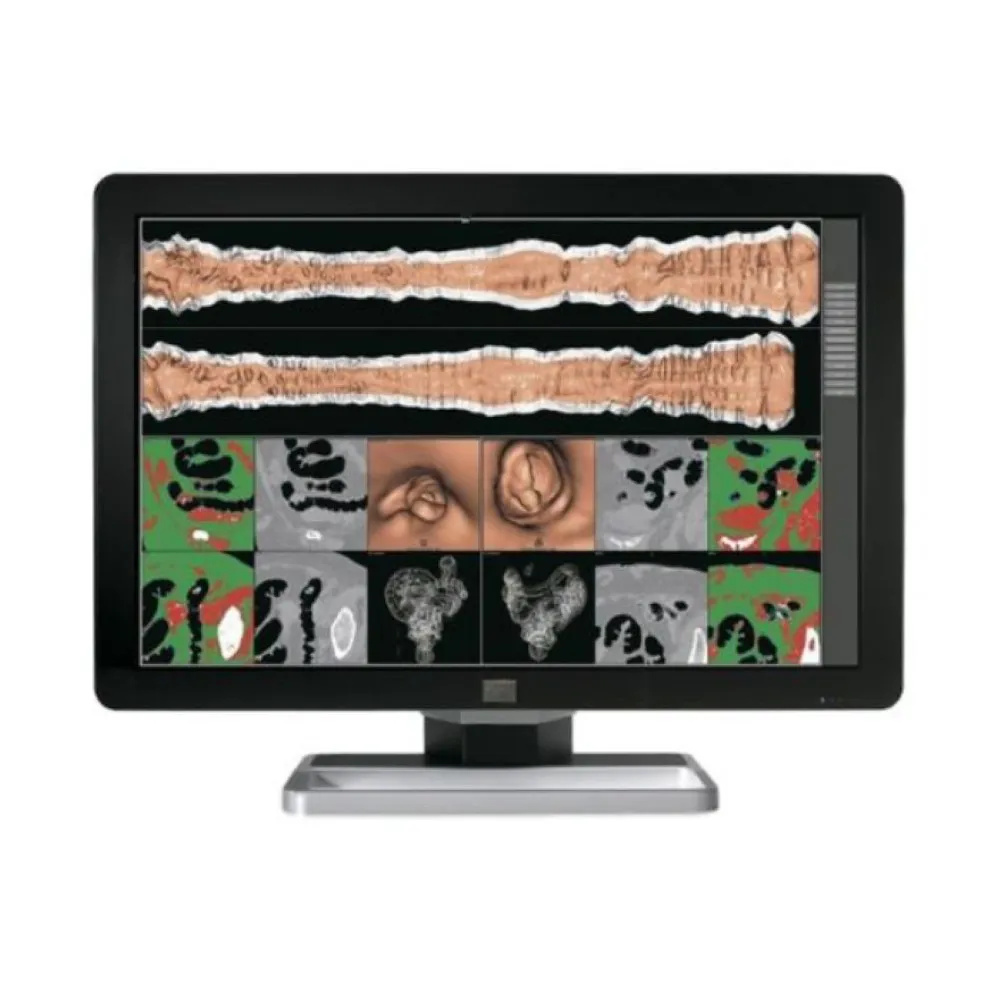Barco Coronis Fusion 6MP DL refurbished monitor